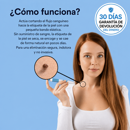 Kit de Eliminación de Verrugas — Sin Dolor